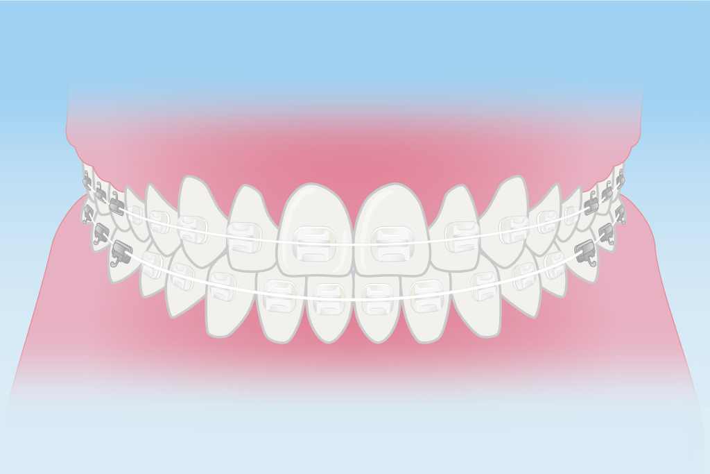 ホワイトワイヤー