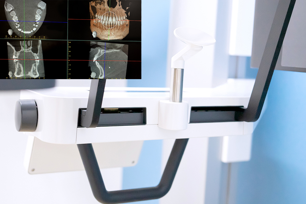 歯科用CT・デジタルレントゲン