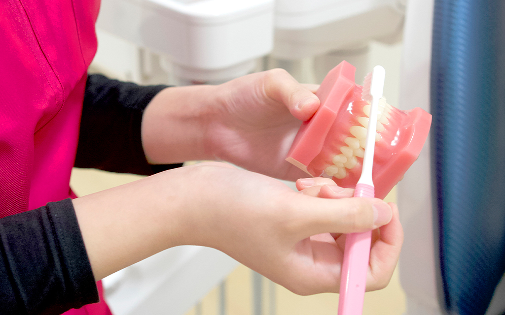 3D口腔スキャナー